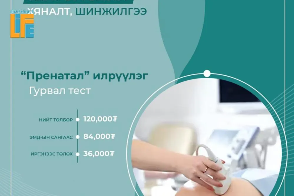 Пренатал илрүүлэг шинжилгээний 70 хувийг ЭМД-ын сангаас хөнгөлнө