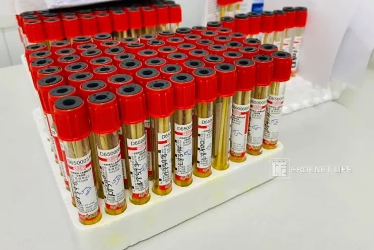 Орхон аймаг: Халдварын хоёр тохиолдол бүртгэгдэж 12 хүн эдгэрчээ